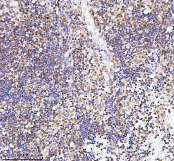 Anti-RBM42 Antibody