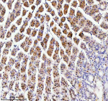 Anti-RBM42 Antibody