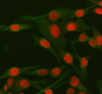 Anti-RBBP8 Antibody