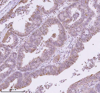 Anti-RBBP8 Antibody