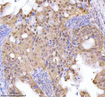 Anti-RBBP8 Antibody