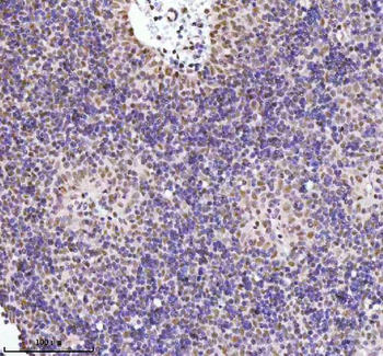 Anti-RBBP8 Antibody
