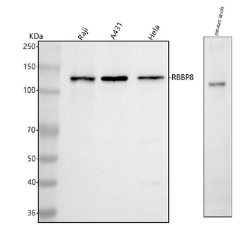 Anti-RBBP8 Antibody