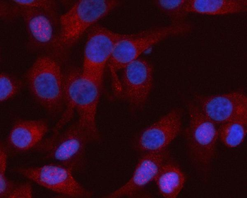 Anti-RASSF8 Antibody
