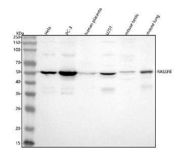 Anti-RASSF8 Antibody