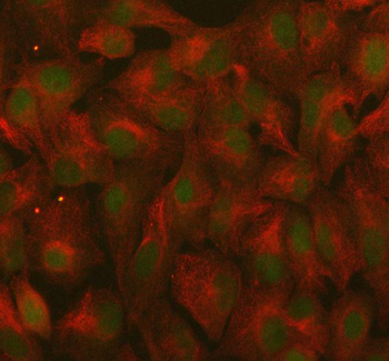 Anti-RANBP9 Antibody