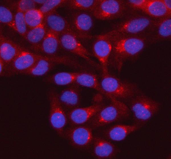 Anti-GNAI2 Antibody