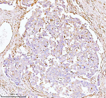 Anti-GNAI2 Antibody