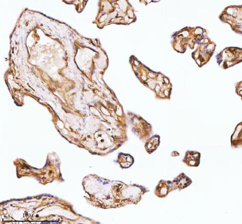 Anti-GNAI2 Antibody