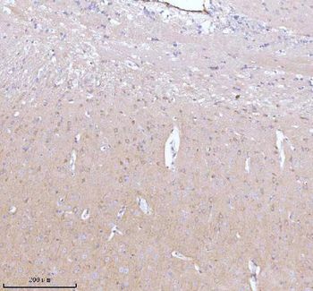 Anti-GNAI2 Antibody