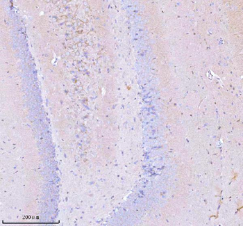 Anti-GNAI2 Antibody