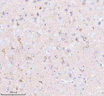 Anti-GNAI2 Antibody