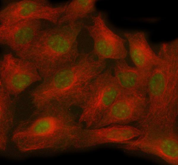 TTC36 Rabbit Polyclonal Antibody