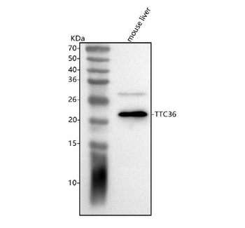 TTC36 Rabbit Polyclonal Antibody