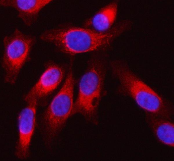 Anti-SQRDL/SQOR Antibody