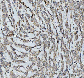 Anti-SQRDL/SQOR Antibody