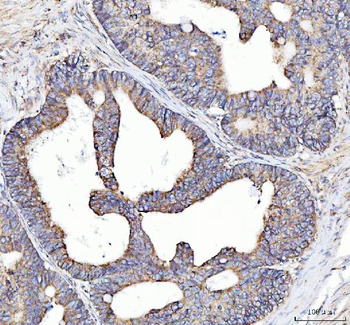 Anti-SQRDL/SQOR Antibody