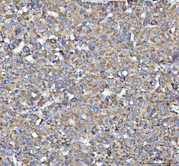 Anti-SQRDL/SQOR Antibody