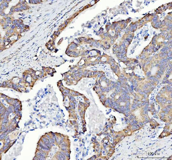 Anti-SQRDL/SQOR Antibody