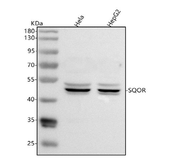 Anti-SQRDL/SQOR Antibody