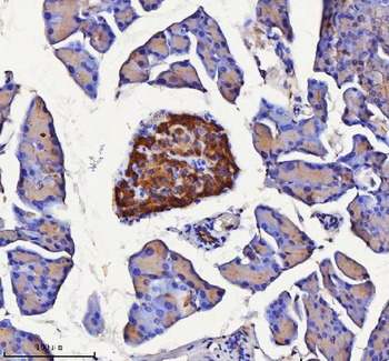 Anti-NPTX2 Antibody