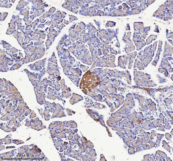 Anti-NPTX2 Antibody