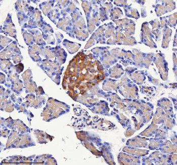 Anti-NPTX2 Antibody