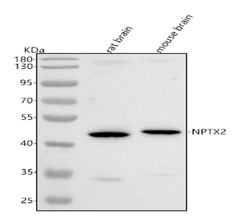 Anti-NPTX2 Antibody