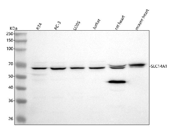 Anti-UT-B/SLC14A1 Antibody