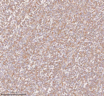 Anti-UT-B/SLC14A1 Antibody