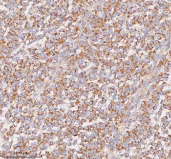 Anti-UT-B/SLC14A1 Antibody