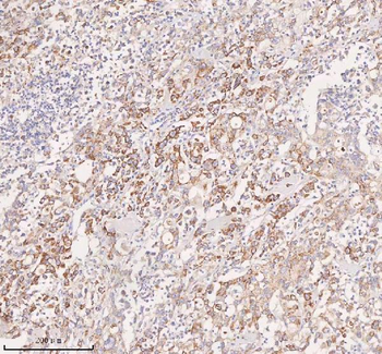 Anti-UT-B/SLC14A1 Antibody