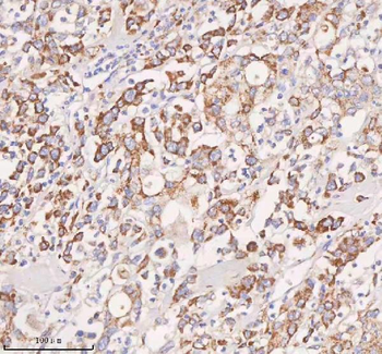 Anti-UT-B/SLC14A1 Antibody