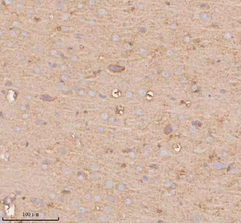 Anti-UT-B/SLC14A1 Antibody
