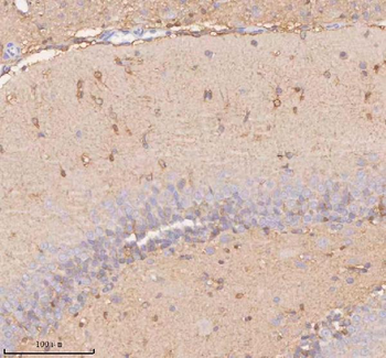 Anti-UT-B/SLC14A1 Antibody