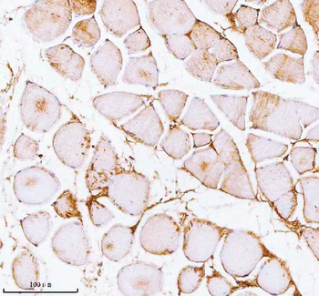 Anti-PFKM Antibody