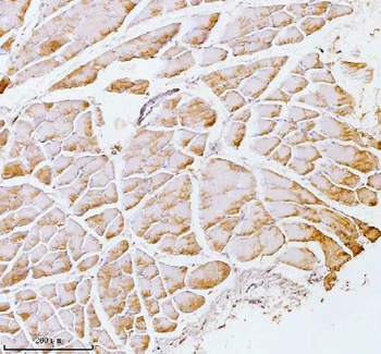 Anti-PFKM Antibody