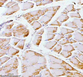 Anti-PFKM Antibody