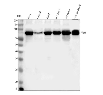 Anti-PFKM Antibody