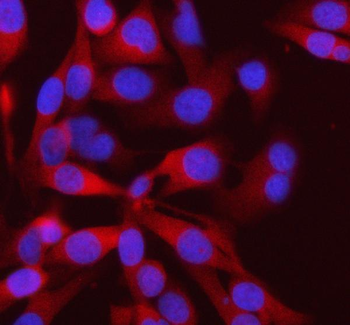 Anti-PFKM Antibody