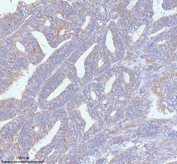 Anti-PFKM Antibody