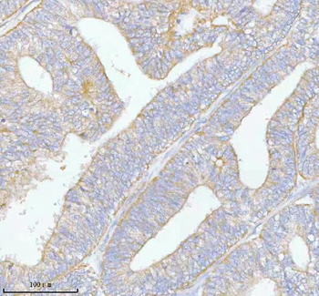 Anti-PFKM Antibody
