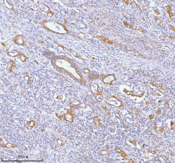 Anti-PFKM Antibody
