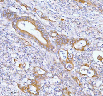 Anti-PFKM Antibody