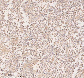 Anti-PFKM Antibody