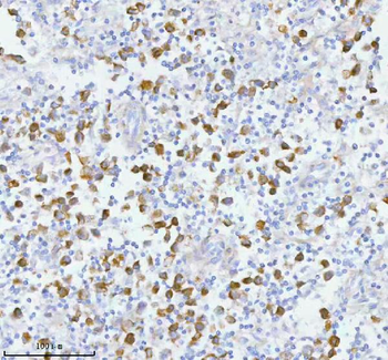 Anti-PCYOX1 Antibody