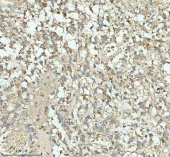 Anti-PACSIN1 Antibody
