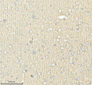 Anti-PACSIN1 Antibody
