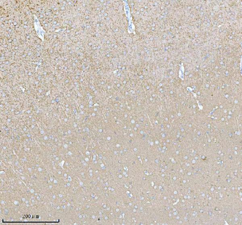 Anti-PACSIN1 Antibody