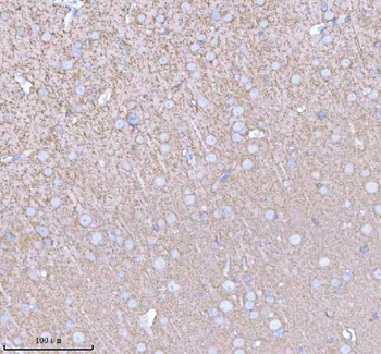 Anti-PACSIN1 Antibody